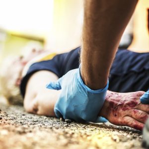 Serious Injuries