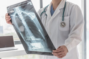 How Bowen Painter Injury Lawyers Can Help After a Cancer Misdiagnosis in Savannah, GA